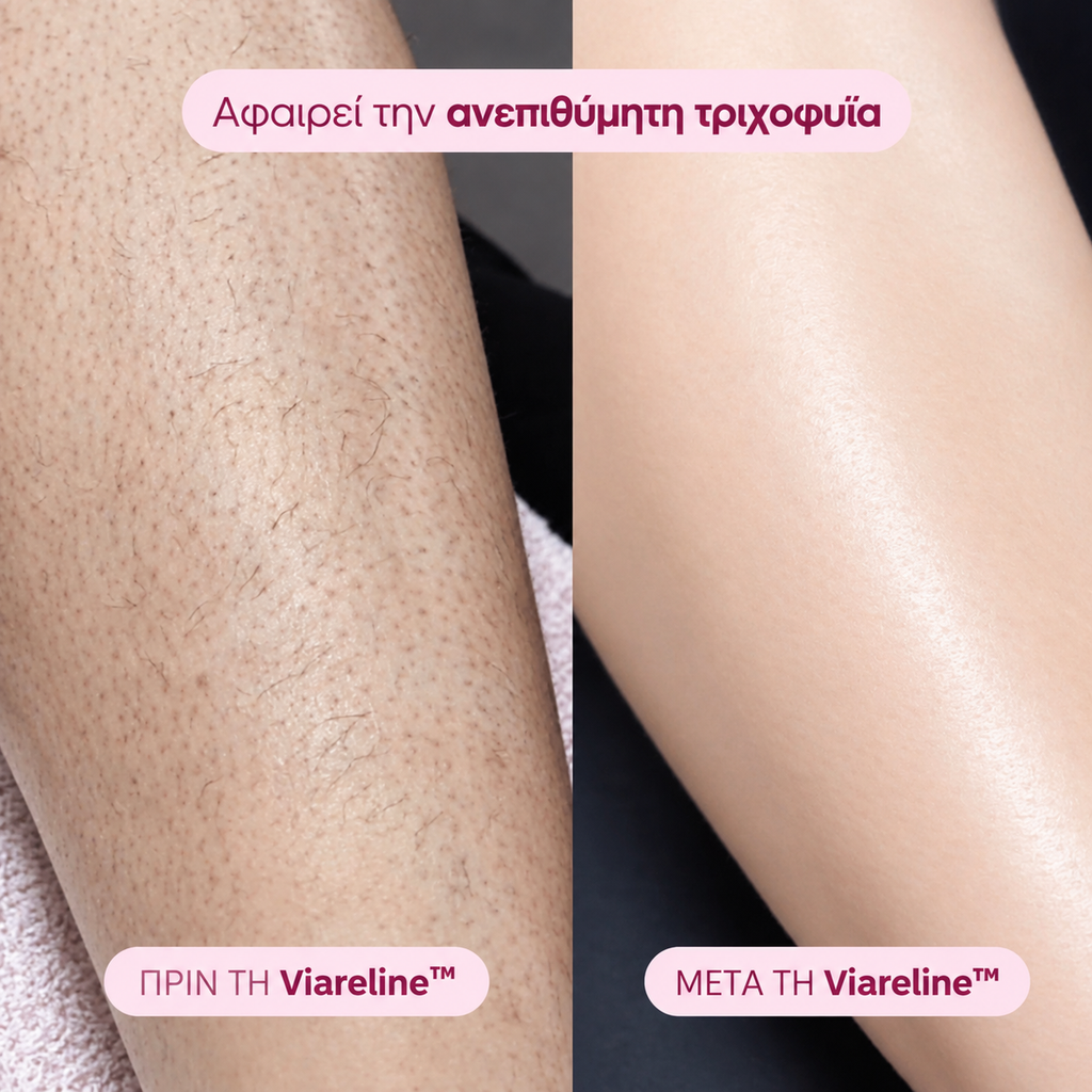 Viareline™ – Αποτριχωτική Συσκευή 2 σε 1